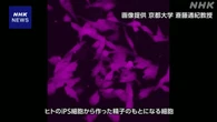 ヒトiPS細胞からの精子卵子で受精させる研究 テーマ限り容認へ