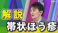 【動画解説】“帯状ほう疹”が増加 症状は？ワクチン補助は？
