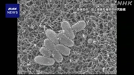 百日せきの流行続く 全国の患者数 過去最多を更新