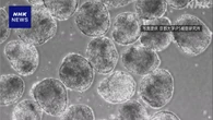 iPS細胞でパーキンソン病の治療 大阪の製薬会社などが承認申請