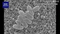 百日せき 1週間の患者数 400人近く減も依然高水準