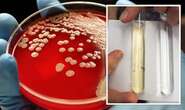 US on alert over rare tropical disease – deadly bacteria detected in US soil and water