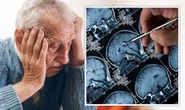 Alzheimer’s breakthrough as new algorithm 99% accurate at identifying brain changes