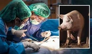 US surgeons successfully transplant pig kidney to human: 'Worked immediately!'