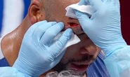 Team GB super-heavyweight Frazer Clarke suffers gruesome cut as Olympic dreams crushed