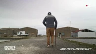Amputé faute de SAV ?