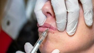 Injections illégales de botox : "Trois nouveaux cas graves" qui s'apparentent à du "botulisme" signalés par l'ANSM depuis le printemps 2025