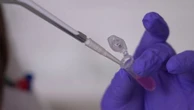 Cancer : un vaccin porteur d’espoir