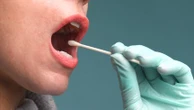 À quoi servent les inocles, ces brins d'ADN géants dans notre bouche ?