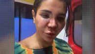 "J'ai pris de nombreux coups dans la tête, dans le nez", raconte l'influenceuse Soraya Riffy après sa violente agression à son domicile