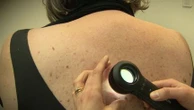 Santé : bientôt une loi pour encadrer les dépassements d’honoraires ?