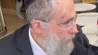 Rabbin agressé à coups de chaise à Neuilly-sur-Seine : "Au début, je pense que c'est une cheminée qui vient de me tomber sur la tête", raconte la victime, Elie Lemmel
