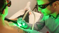 Après la mode du tatouage, c’est au tour de celle du détatouage