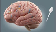 Un cucchiaino di microplastiche nel nostro cervello. I ricercatori: “Possibile causa di demenza”