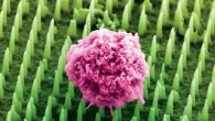 Tumori, un “cerotto” con nanoaghi per analisi in tempo reale. Anche senza biopsia