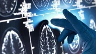 Uno studio italiano rivela un meccanismo chiave per la progressione dell’Alzheimer