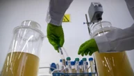 Junk food, un esame del sangue o delle urine svela quanto ne mangi. Il pericolo molecola tossica