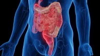 Malattia di Crohn: scoperto un meccanismo alla base della malattia