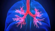 Ipertensione polmonare, cos’è e come si riconosce la malattia che “toglie” il respiro