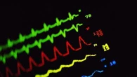 Fibrillazione atriale: sì, l’attività fisica aiuta a gestire la malattia