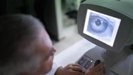 Cataratta: tutto quello che c’è da sapere sui problemi post-operatori