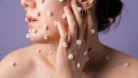 Acne, come affrontare l’effetto rebound da rientro