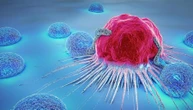 Tumori, scoperta la proteina che ‘blocca’ le difese immunitarie
