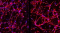 Retina, così le staminali possono riparare i vasi sanguigni