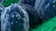Tumore alla prostata, una nuova strategia per ridurre le biopsie inutili