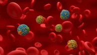 Colesterolo-LDL, troppe particelle ultrapiccole e cresce il rischio di Alzheimer