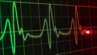 Infarto, con l’Intelligenza Artificiale cure su misura per i casi più complessi