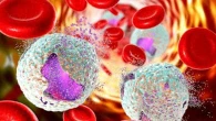 Leucemia linfoblastica cronica, per i pazienti nuova terapia che superare le resistenze