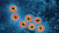 Herpes zoster, in chi si vaccina minor rischio di infarto, ictus e scompenso cardiaco