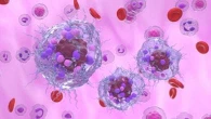 Tumori neuroendocrini: nuova terapia riduce dell’81% rischio peggioramento