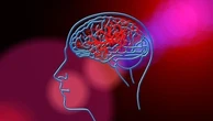 Ictus e infarto, con la tecnica “aspira e ruota” attacco diretto ai trombi pericolosi