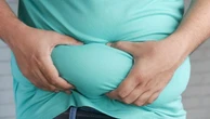 Obesità e infiammazione cronica, una minaccia per la nostra vita