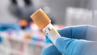 Hiv, la Prep a lunga durata anche in Italia: potrebbe migliorare l’aderenza alla terapia