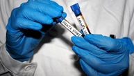 Rischio di pandemia, contagi, terapie: tutti i misteri dell’Hantavirus