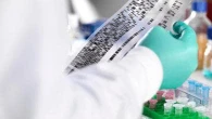 Tumore del colon, studio italiano svela come muta il suo Dna