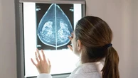 Tumori della mammella e del colon, al Sud persi più anni di vita