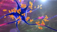 Il trapianto di cellule staminali "azzera" una rara patologia autoimmune