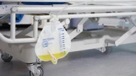 Infezioni urinarie: funziona il catetere resistente ai batteri