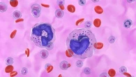 Leucemia mieloide cronica, agire subito per vivere più a lungo