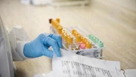 Infarto e non solo: perché funzionano gli screening in farmacia o allo stadio