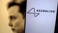 Neuralink, migliaia di volontari per il primo chip nel cervello umano: quanto costerà e a cosa servirà