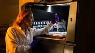 Tumore al seno metastatico, la ricerca sugli inibitori CDK non si ferma
