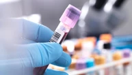 Alzheimer, nel test per la diagnosi precoce ci sono nanoparticelle d’oro