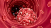 Ictus ischemico, grazie ai farmaci si può sciogliere il trombo (ma se si fa presto)