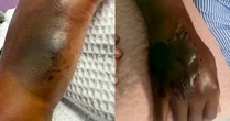 Đến nhà bạn lấy máy xay trên giá để giày, người đàn ông tưởng bị mèo cào nhưng phải đi cấp cứu gấp