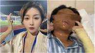 Nữ streamer xinh đẹp bị “hủy dung” sau khi mở gói hàng, danh tính shipper được tiết lộ khiến cô hoảng sợ